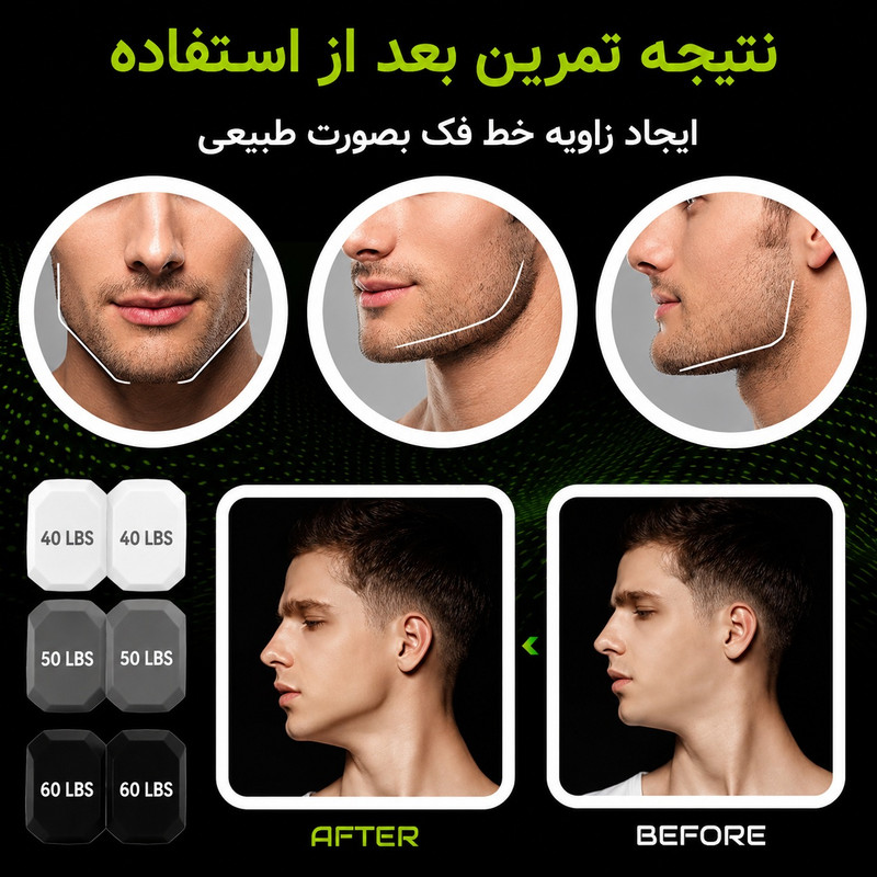 تقویت کننده فک آیدی فیت مدل زاویه ساز بسته 6 عددی