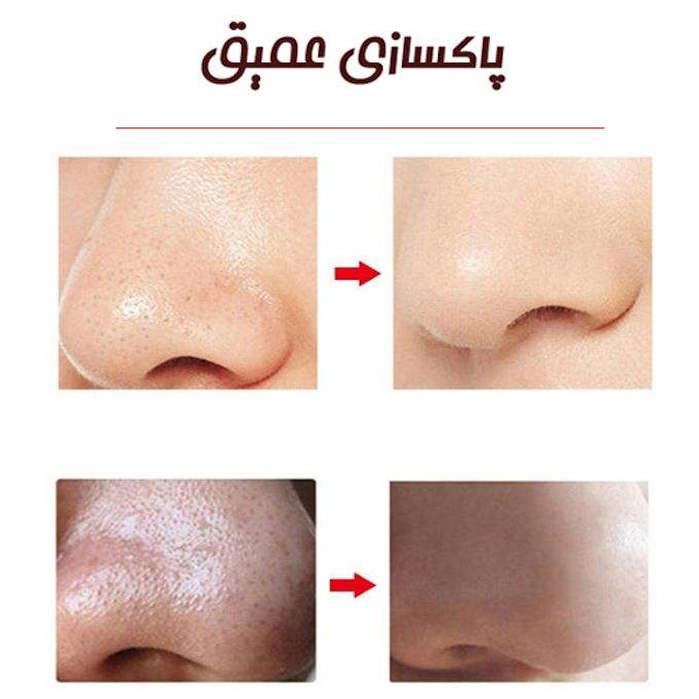 میکرودرم خانگی گلویش استایل مدل MP-29