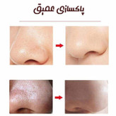 میکرودرم خانگی گلویش استایل مدل MP-29
