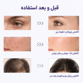 دستگاه جوانسازی هایفرکوئنسی اسپاتی مدل SPTY-4PRP