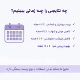 دستگاه جوانسازی هایفرکوئنسی اسپاتی مدل SPTY-4PRP