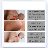 میکرودرم خانگی مدل X17